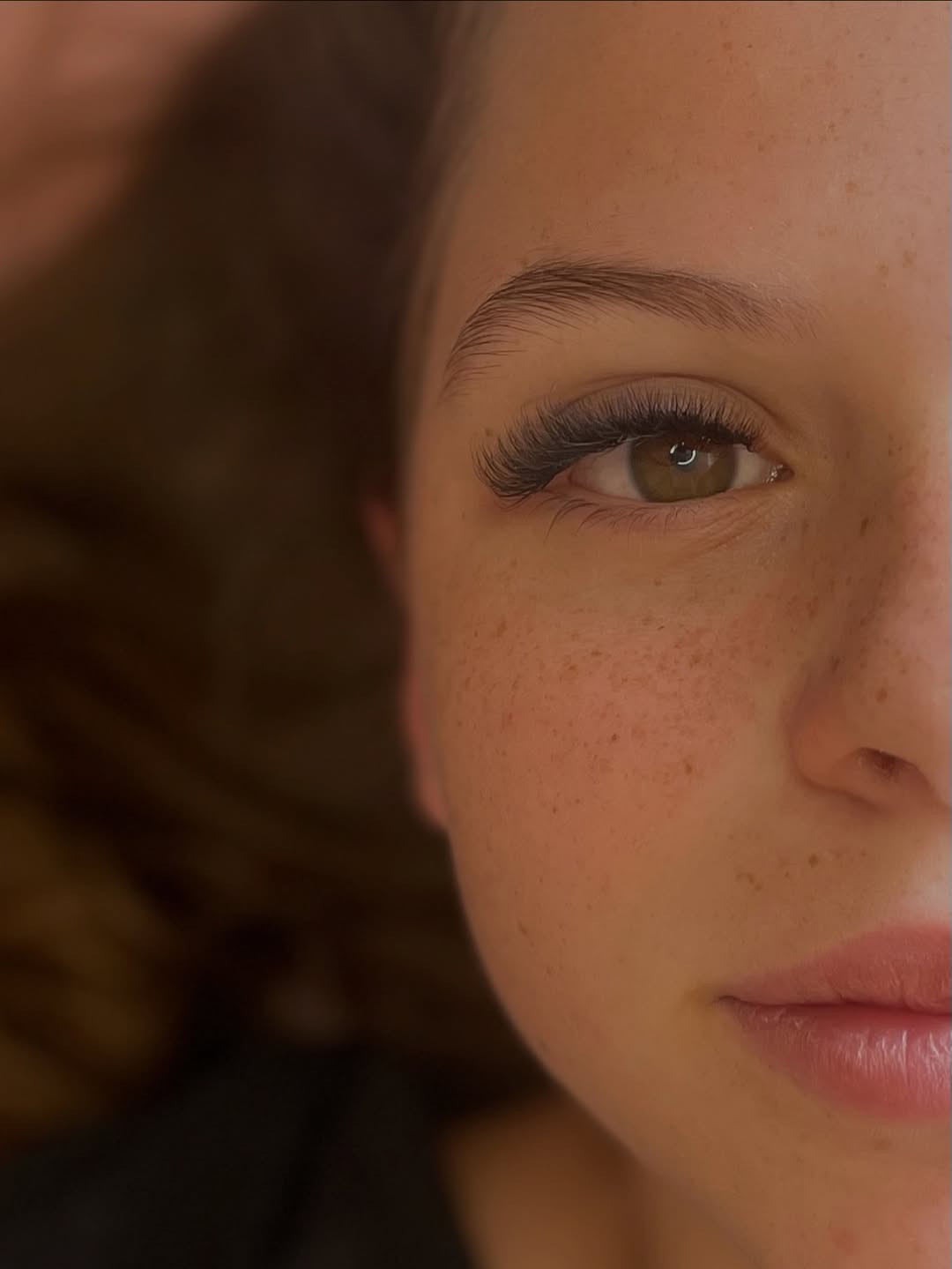 Depois do procedimento